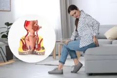 hemorrhoids Piles Rectal cancer constipation blood fissure fistula perianal abscess