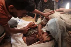 رجل فلسطيني جريح يودع طفل قُتل في غارة إسرائيلية في منطقة مواصي خان يونس،  أمام مشرحة في مستشفى ناصر  في 13 يوليو/تموز 2024