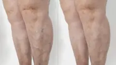 બીબીસી ગુજરાતી, ગુજરાત, બીબીસી, અમદાવાદ, હેલ્થ, સ્વાસ્થ્ય,