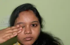 కళ్ల కలకలు