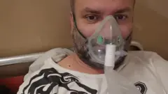"Один помирає, через 20 хвилин в палату завозять іншого". Розповідь львів'янина, який поборов Covid-19