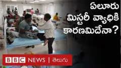ఏలూరులో అంతుచిక్కని వ్యాధి