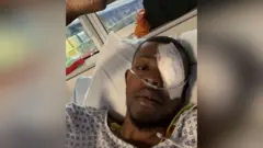 Farid Oladapo in hospital bed with eye patch