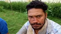 कोरोना