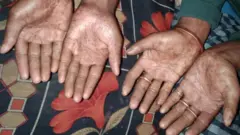 অমল সরকার এবং অপু সরকারের হাত