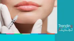 صورة عامة لعملية تجميل