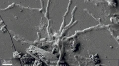 Imagen de tomografía de neuronas y los axones del cerebro.