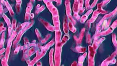 Aspergillus fumigatus

