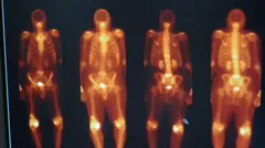 Imagens do corpo usando tecnécio.