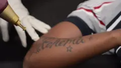 Gucci akitolewa tattoo na mashine ya Laser