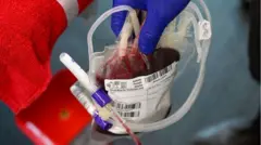 Mão com luva segura uma bolsa hospitalar cheia de sangue, conectada a tubos transparentes