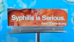 যুক্তরাষ্ট্রের ক্যালিফোর্নিয়ায় সিফিলিস প্রাদুর্ভাবের ওপর একটি সাইনবোর্ড