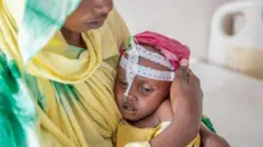 ዝሓመመ ህጻን ዝሓቖፈት ኣዶ