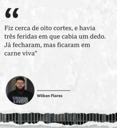 Foto de Wilken Flores com a seguinte aspa: 'Fiz cerca de oito cortes, e havia três feridas em que cabia um dedo. Já fecharam, mas ficaram em carne viva'