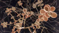 ilustrasi jamur Sporothrix 