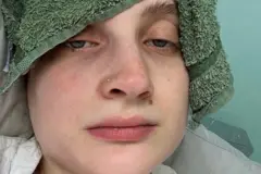 Ella Marcham aparenta indisposição e usa uma toalha úmido na testa