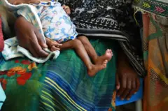ኣደ፡ ብሕፅረት ምግቢ ኣዝዩ ምስ ዝተሃሰየ ውላዳ ኣብ ሆስፒታል ዓይደር 
