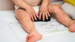 টমেটো ফ্লু