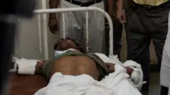 meningococcal patient