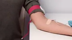 प्लाज़्मा थेरेपी