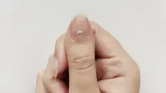 Hannun wani mutum yana nuna farcensa 