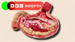 A treated image of a gut