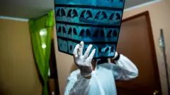 L'étude des personnes qui présentent des niveaux inhabituels de résistance ou de sensibilité au Covid-19 pourrait déboucher sur de nouveaux traitements