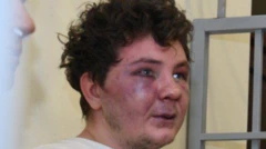 Задержанный Сергей Софронов с гематомами на лице