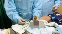 Ọkunrin naa lasiko ti awọn dokita n ge irin agadagodo