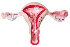 Kí ló dé táwọn obìnrin kan fi máa ń ní ilé ọmọ méjì, báwo ni obìnrin ṣe le mọ̀ àti ipa tó le ní lára wọn?