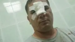 Калтакланган блогер