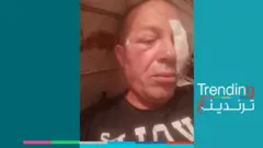 تضامن مع سائق قطار الدقهلية بمصر بعد رشقه بالحجارة