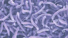 Cholera
