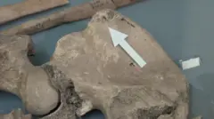 Partes de um esqueleto são exibidas com uma seta indicando a área do osso ilíaco onde foi encontrada a marca da mordida.