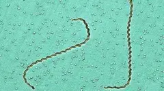 Tanzania names disease of concern as Leptospirosis