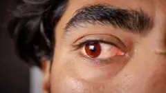 පුද්ගලයෙකුගේ ඇසක සමීප ඡායාරූපයක් 