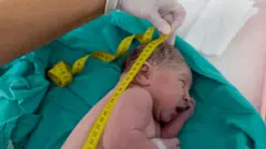 Yeni doğmuş bir bebeğin mezurayla boyu ölçülüyor. 
