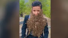 Dečak nosi stotine pčela na licu