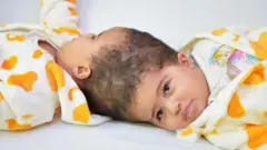 'ፈጣሪ ይመስገን'፡ ተላጊበን ዝተወልዳ ኤርትራውያን ማናቱ ብመጥባሕቲ ተፈላልየን