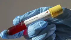 ਕੋਰੋਨਾਵਾਇਰਸ