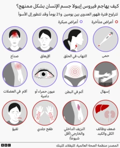 غرافيك يطهر أعراض السلالة الجديدة لفيروس إيبولا.