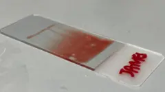 Una foto del portaobjeto donde está parte de la muestra de sangre extraída del periodista de la BBC.