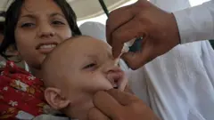 پولیو کے قطرے