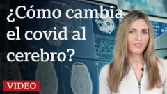 El estudio que muestra cómo cambia el cerebro tras una infección de covid, aunque esta sea leve