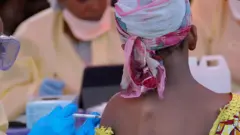 পরীক্ষায় দেখা যাচ্ছে ইবোলায় আক্রান্তরা শুরুতেই চিকিৎসা নিলে সুস্থ হতে পারবেন