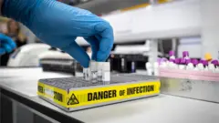 Les autorités égyptiennes ont officiellement annoncé dimanche le premier décès par Coronavirus. Un allemand de 60 ans