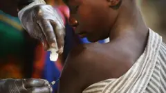 MTOTO