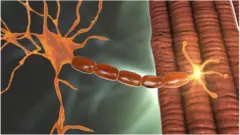 বিরল স্নায়ুরোগ স্পাইনাল মাস্কুলার এট্রফি