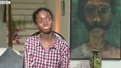 Nisha Lobo tem um problema genético na pele