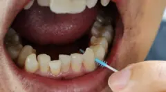 Uma pessoa limpando o espaço entre os dentes com uma escova interdental
